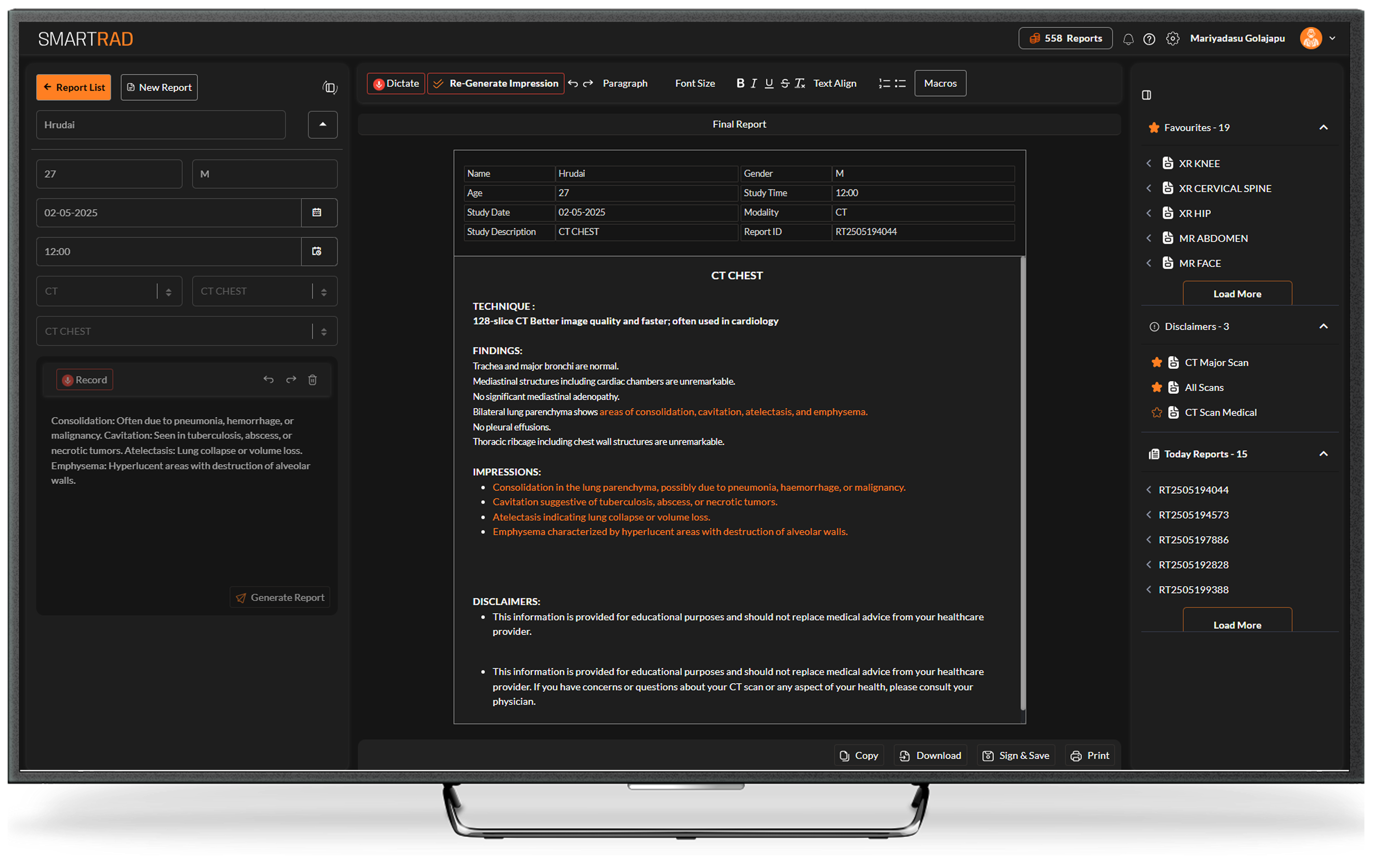 SmartRad reporting editor